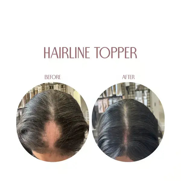 🎀Hairline Topper