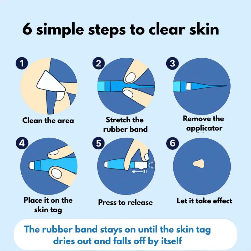SerryLine™ Complete Set – For Skin Tag Concerns