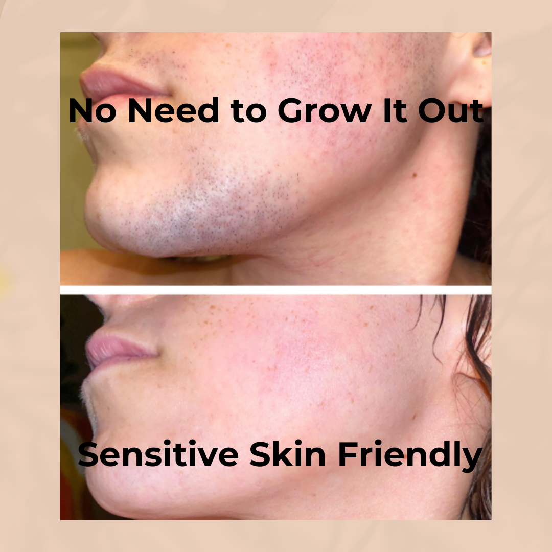 Hair Removal Kit