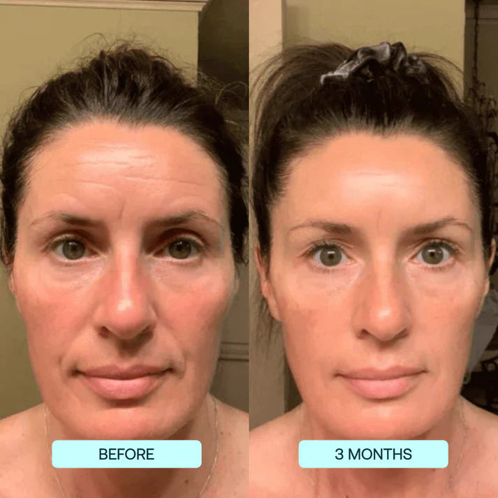 Lifting Collagen Patches (10 Full-Face Treatments)
