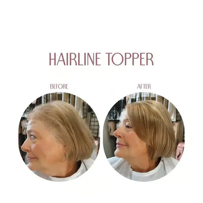 🎀Hairline Topper